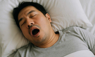 Thắc mắc thường gặp về ngủ ngáy