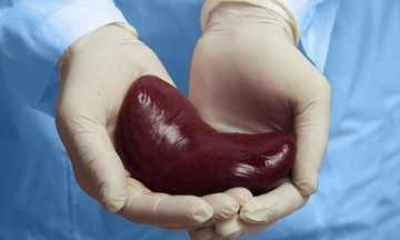 Người đàn ông nhiễm HIV hồi sinh nhờ thận vợ hiến tặng