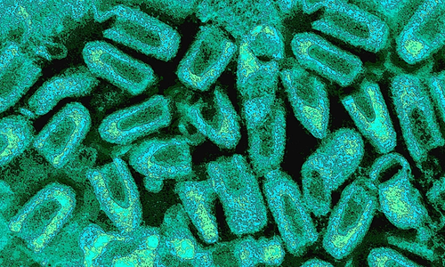 Boy dies from rabies with unknown source