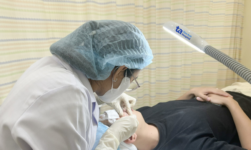 Chiến thuật điều trị ba giai đoạn giúp chàng trai giảm sẹo rỗ