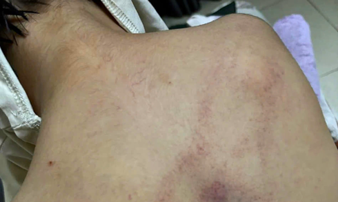 4-year-old girl traumatized after being hit by teacher