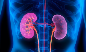 Glomerulonephritis can lead to kidney failure