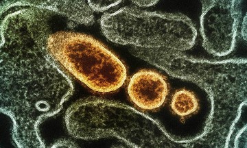 Vaccine phòng virus Nipah tiếp tục thử nghiệm trên người
