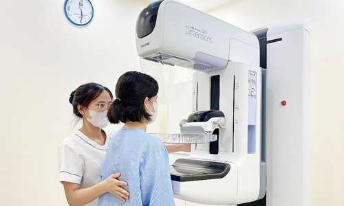 Follow-up care after breast cancer surgery