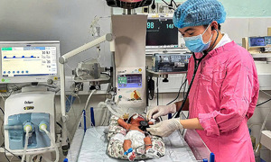 Trẻ sơ sinh 700 g bị suy hô hấp nặng được cứu sống