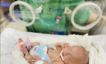 Y học hiện đại giúp nuôi sống trẻ sinh non nhỏ bằng bàn tay