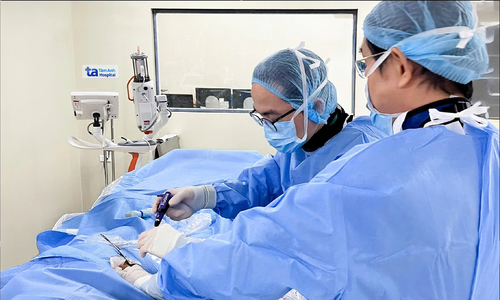 Phình động mạch chủ ngực kèm u nhầy ruột thừa