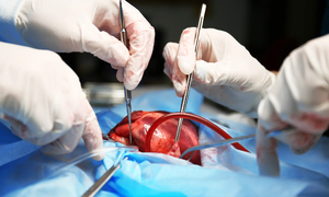 New methods expand access to donor hearts for transplants