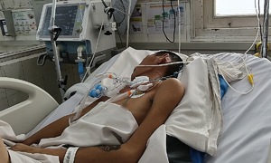 Young man paralyzed by Japanese encephalitis, two years on ventilator