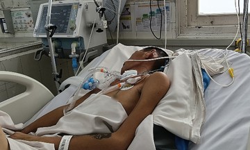 Thanh niên viêm não Nhật Bản liệt tứ chi, hai năm chưa cai máy thở