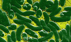 4 deaths in Florida linked to flesh-eating bacteria