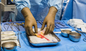 Kentucky organ donation scandal raises ethical questions