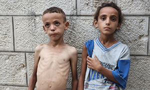 Skeletal children in Gaza