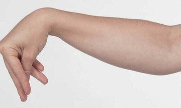 Lời giải cho những cơn co rút, khó thở kéo dài của cô gái 19 tuổi
