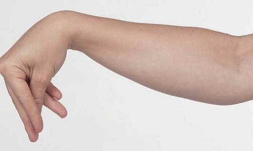 Lời giải cho những cơn co rút, khó thở kéo dài của cô gái 19 tuổi