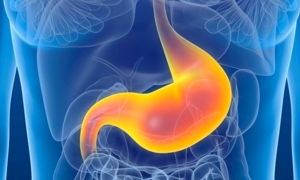 Diet tips for faster healing of stomach and duodenal ulcers