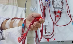 Acute kidney injury from dengue fever