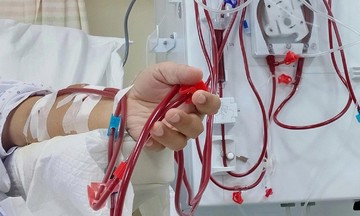 Suy thận cấp do sốt xuất huyết