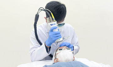Làm mờ vết sẹo bằng laser 4D