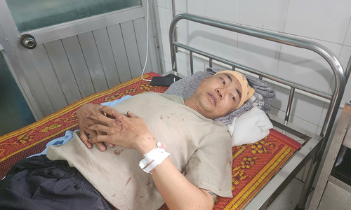 Một nạn nhân vụ lật xe khách ở Hà Tĩnh nguy cơ bị liệt