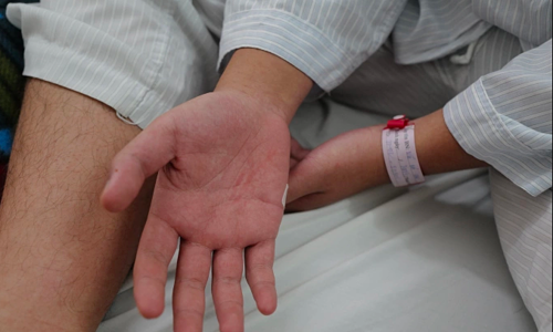 Dengue fever cases double in Hanoi