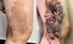 Le Sang transforms scars into artistic tattoos