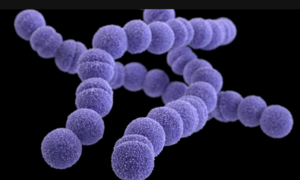 Pork streptococcus infection after processing pork crackling