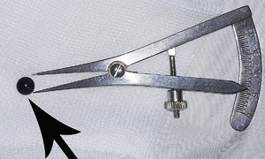 Teenager has metal pellet removed from eyelid