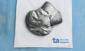 Metal object lodges in 6-year-old girl's face