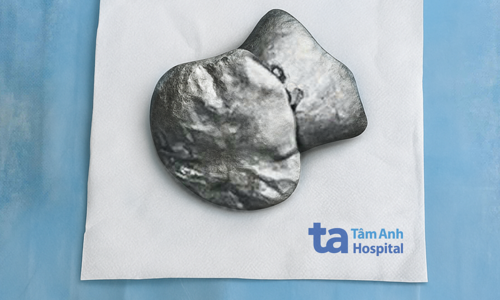 Metal object lodges in 6-year-old girl's face