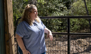 Woman's liposuction ordeal: 'Like being skinned alive'