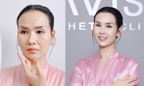 Huyền Baby tư vấn Võ Hạ Trâm làm đẹp sau sinh con thứ hai