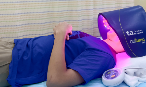 Treating acne scars and restoring skin