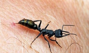 Anaphylactic shock after ant bites