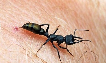 Sốc phản vệ sau khi bị kiến cắn
