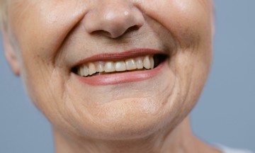 Lý do người sống thọ thường giữ được răng thật đến cuối đời