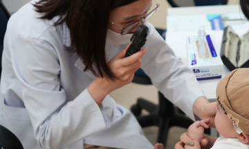 Rận mu đẻ trứng trên mi mắt bé gái