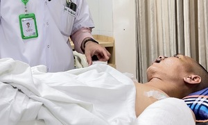 Doctors save man with ruptured liver and exposed organs after traffic accident