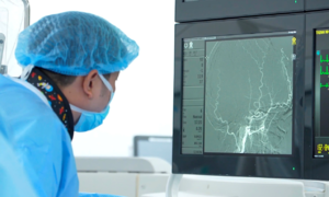 Brain tumor discovered during stroke screening