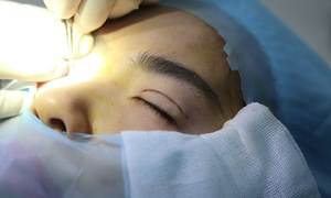 Understanding eye anatomy crucial for eyelid surgery