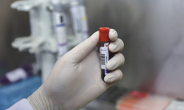 Loại enzyme 'bí ẩn' trong máu khiến trẻ bị chẩn đoán nhầm bệnh