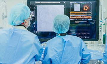 Nhồi máu não kèm hẹp động mạch vành nguy cơ nhồi máu tim
