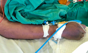 Hanoi records first streptococcus suis fatality of the year