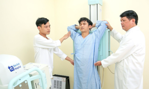 Can X-rays detect lung cancer early?