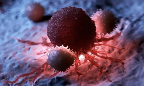 7 daily habits that increase cancer risk