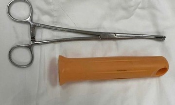 Cấp cứu vì tự nhét cán lau nhà 15 cm vào hậu môn