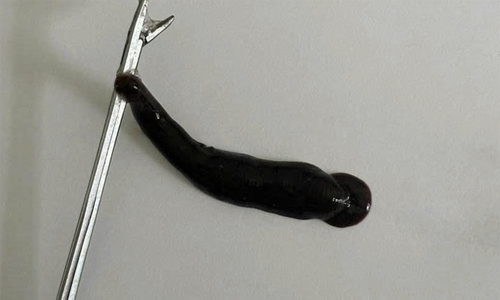 Leech found living in teenager's nose for 10 days