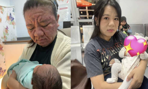 Unexpected fame after pregnancy transforms woman's face