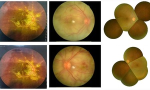 Man’s sight suddenly deteriorates