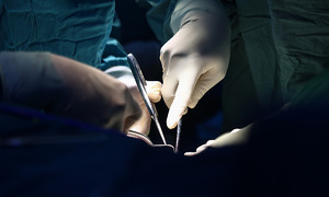 Ovarian teratoma nearly claims woman's life